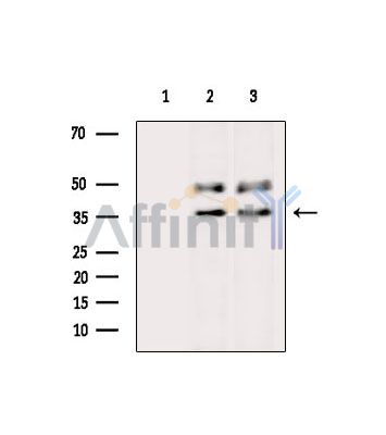 ALG5 Antibody - Western blot analysis of extracts from various samples, using ALG5 Antibody.