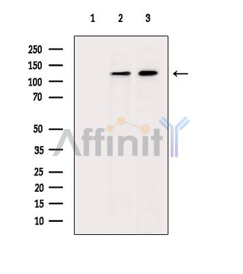 ESYT1 Antibody - Western blot analysis of extracts from various samples, using ESYT1 Antibody.