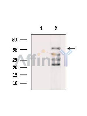 GSG1L Antibody - Western blot analysis of extracts from Hela cells(heat-shock treatment), using GSG1L Antibody.