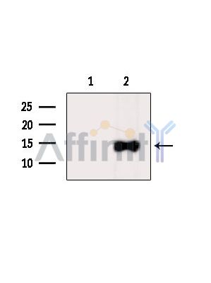 TXNDC17 Antibody - Western blot analysis of extracts from Hela cells(heat-shock treatment), using TXNDC17 Antibody.