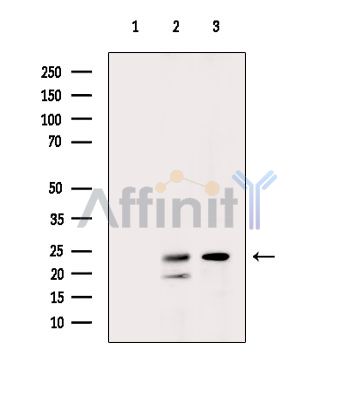 SELENOT Antibody - Western blot analysis of extracts from various samples, using SELENOT Antibody.