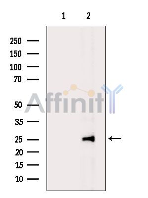 DLX1 Antibody - Western blot analysis of extracts from Mouse brain, using DLX1 Antibody.