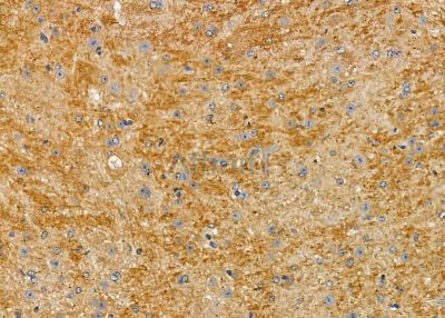 PIK3R3 Antibody - DF2629 at 1/100 staining mouse brain tissue by IHC-P.