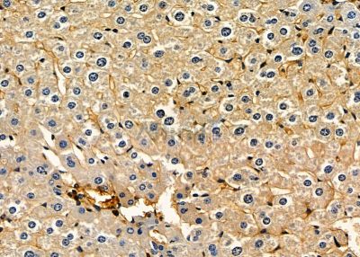 NQO2 Antibody - DF7342 at 1/100 staining mouse liver tissue by IHC-P.