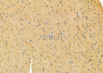 ACTN3 Antibody - DF8016 at 1/100 staining mouse heart tissue by IHC-P.