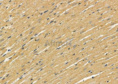 ACTN3 Antibody - DF8016 at 1/100 staining rat heart tissue by IHC-P.