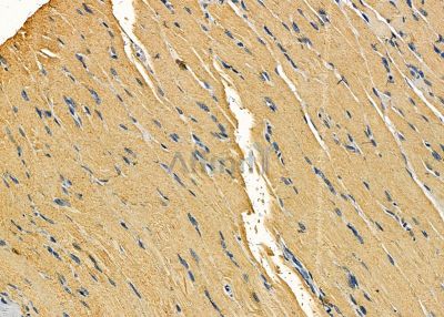 ACTN3 Antibody - DF8016 at 1/100 staining rat muscle tissue by IHC-P.