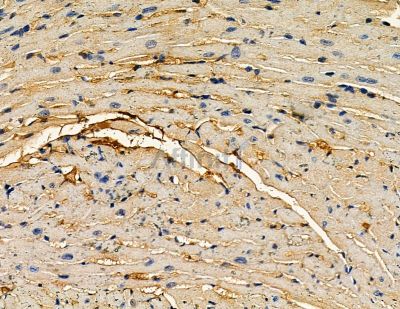 Tensin-2 Antibody - DF8623 at 1/100 staining mouse heart tissue by IHC-P.