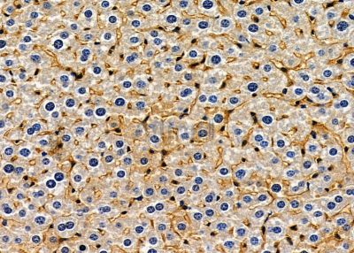 Trypsin-3 Antibody - DF8625 at 1/100 staining mouse liver tissue by IHC-P.