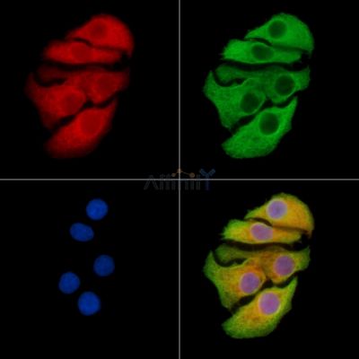 AIFM2 Antibody - DF8636 staining Hela cells by IF/ICC.