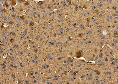 OR13C2/13C9 Antibody - DF8688 at 1/100 staining mouse brain tissue by IHC-P.