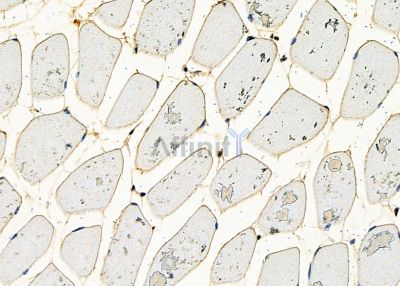 ZNF7 Antibody - DF8791 at 1/100 staining mouse muscle tissue by IHC-P.