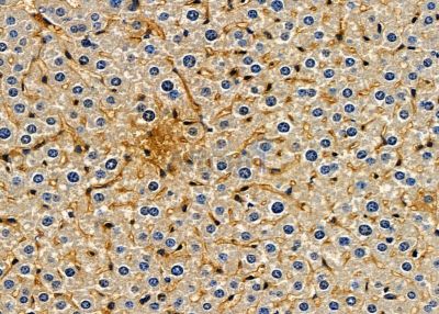 LRRK1 Antibody - DF8834 at 1/100 staining mouse liver tissue by IHC-P.