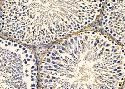 LRRK1 Antibody - DF8834 at 1/100 staining rat testis tissue by IHC-P.