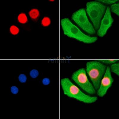 Ubinuclein Antibody - DF8873 staining Hela cells by IF/ICC.