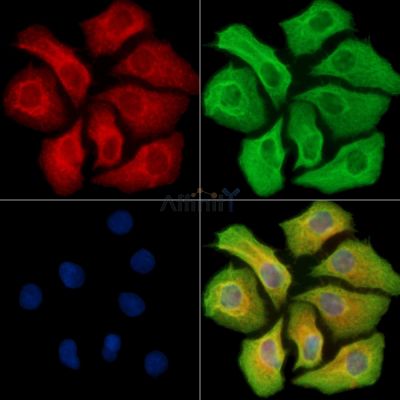Collagen VIII  alpha 2 Antibody - DF8903 staining Hela cells by IF/ICC.