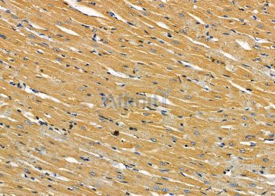 ILRL2 Antibody - DF8987 at 1/100 staining rat heart tissue by IHC-P.