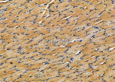 ILRL2 Antibody - DF8987 at 1/100 staining rat muscle tissue by IHC-P.