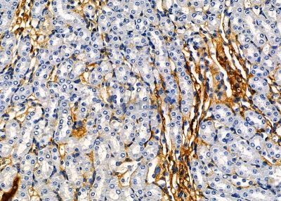 KRT81 Antibody - DF9012 at 1/100 staining mouse kidney tissue by IHC-P.