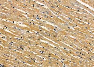 TUBE1 Antibody - DF9034 at 1/100 staining rat heart tissue by IHC-P.