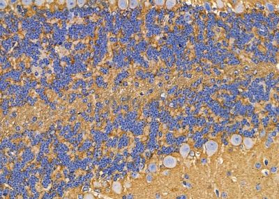 ABHD10 Antibody - DF9141 at 1/100 staining mouse brain tissue by IHC-P.