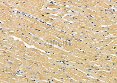 ABHD10 Antibody - DF9141 at 1/100 staining rat heart tissue by IHC-P.
