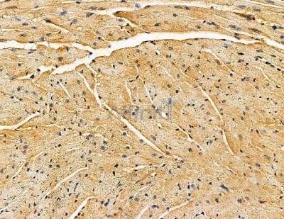 ANGPTL5 Antibody - DF9211 at 1/100 staining mouse heart tissue by IHC-P.