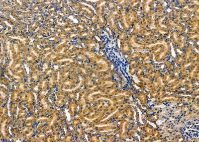 CHST3 Antibody - DF9329 at 1/100 staining rat kidney tissue by IHC-P.