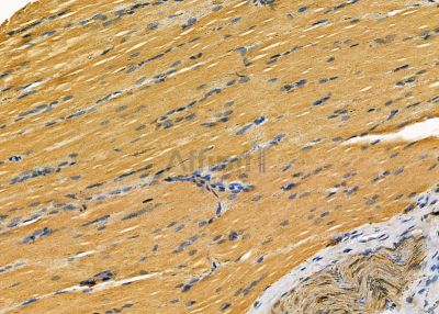 CHST3 Antibody - DF9329 at 1/100 staining rat muscle tissue by IHC-P.