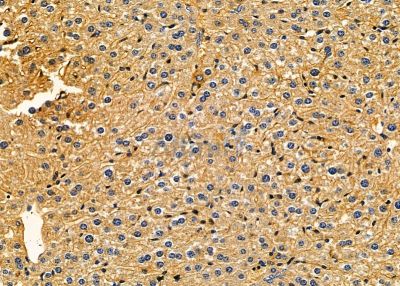 CA10 Antibody - DF9334 at 1/100 staining mouse liver tissue by IHC-P.