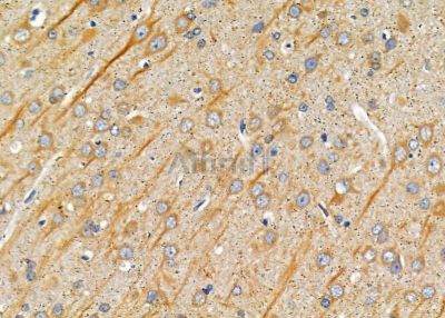 CA11 Antibody - DF9335 at 1/100 staining rat brain tissue by IHC-P.