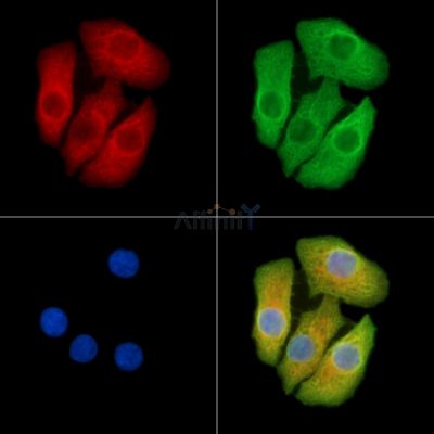 CRABP1 Antibody - DF9358 staining Hela cells by IF/ICC.