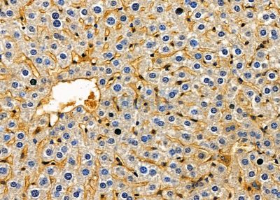 CRABP1 Antibody - DF9358 at 1/100 staining mouse liver tissue by IHC-P.