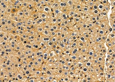 CEP68 Antibody - DF9364 at 1/100 staining mouse liver tissue by IHC-P.