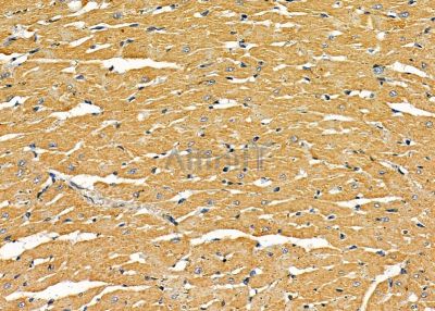 CNDP2 Antibody - DF9428 at 1/100 staining rat heart tissue by IHC-P.