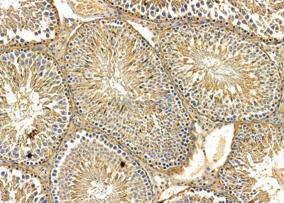 CNDP2 Antibody - DF9428 at 1/100 staining rat testis tissue by IHC-P.