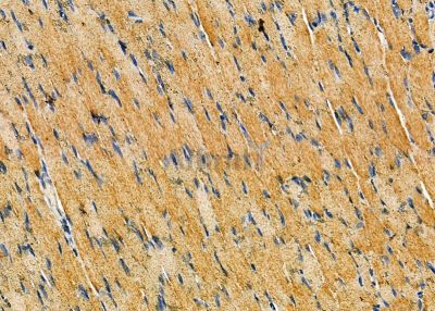 CNDP2 Antibody - DF9428 at 1/100 staining rat muscle tissue by IHC-P.