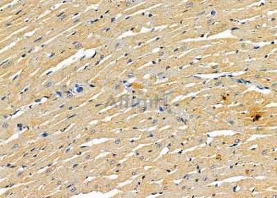 DHRS11 Antibody - DF9436 at 1/100 staining rat heart tissue by IHC-P.