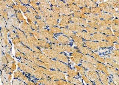 DHRS11 Antibody - DF9436 at 1/100 staining rat muscle tissue by IHC-P.