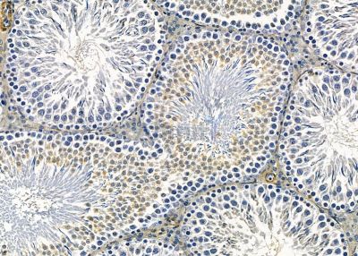 NSMCE2 Antibody - DF9475 at 1/100 staining rat testis tissue by IHC-P.