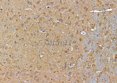 MARCH8 Antibody - DF9484 at 1/100 staining rat brain tissue by IHC-P.
