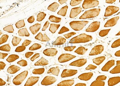 MYBPC2 Antibody - DF9649 at 1/100 staining mouse muscle tissue by IHC-P.