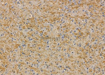 NDUFB7 Antibody - DF9665 at 1/100 staining mouse brain tissue by IHC-P.