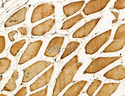 RGS21 Antibody - DF9847 at 1/100 staining mouse muscle tissue by IHC-P.