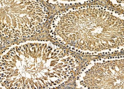 RGS21 Antibody - DF9847 at 1/100 staining rat testis tissue by IHC-P.