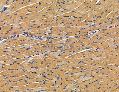 RFPL4B Antibody - DF9851 at 1/100 staining rat muscle tissue by IHC-P.