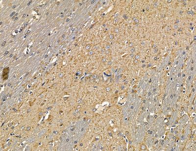 RHG20 Antibody - DF9856 at 1/100 staining rat brain tissue by IHC-P.