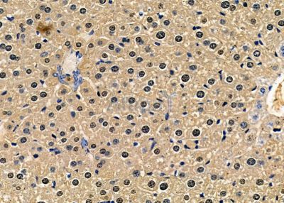 RHOXF1 Antibody - DF9869 at 1/100 staining mouse liver tissue by IHC-P.