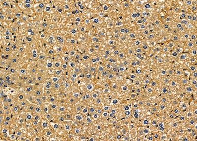 RPAP3 Antibody - DF9875 at 1/100 staining mouse liver tissue by IHC-P.