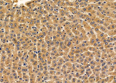 RPAP3 Antibody - DF9875 at 1/100 staining rat liver tissue by IHC-P.